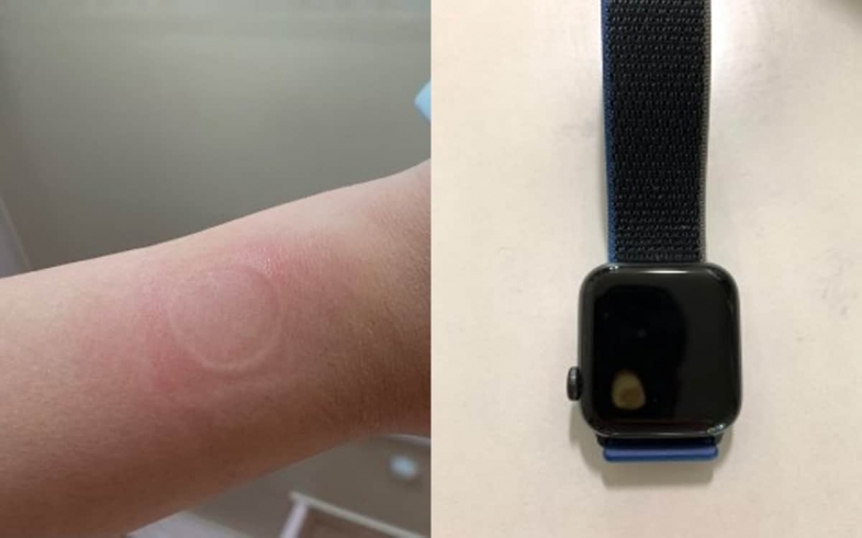 Apple Watch SE Aşırı Isınma Sorunu İle Karşı Karşıya!