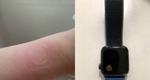 Apple Watch SE Aşırı Isınma Sorunu İle Karşı Karşıya!